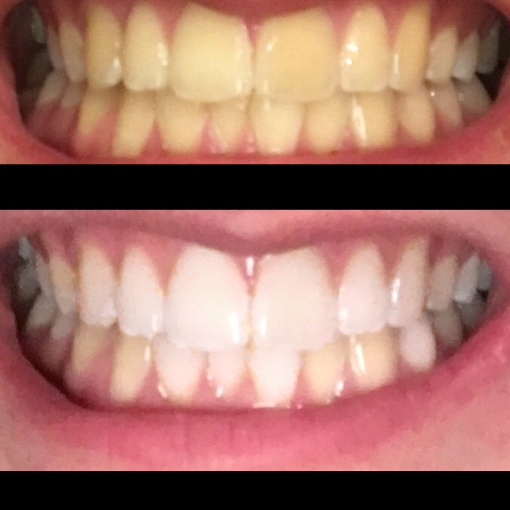 Whitening toothpaste!! Works amazing